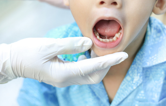 closeup of person with tongue tie 